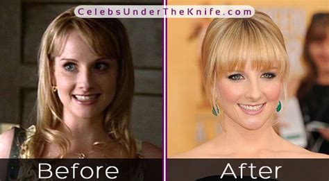 melissa rouch tits|Melissa Rauch Breast Implants and Reductions